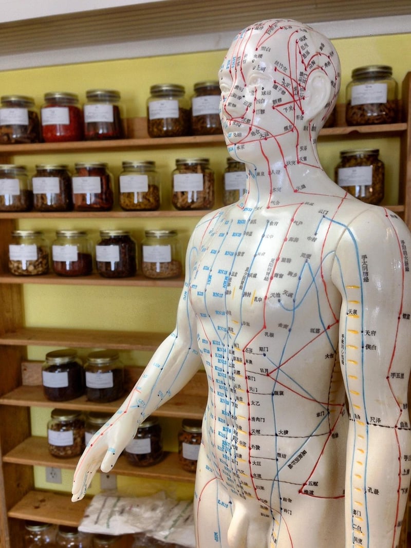 Acupuncture Treatment